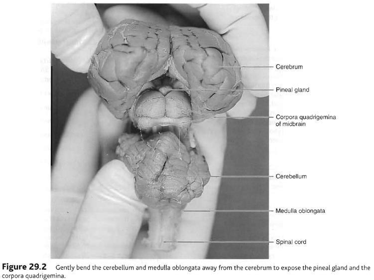 8. With the sample still dorsal side up, locate the following structures on the specimen: A. left & right cerebral hemispheres B. gyrus (gyri) C. sulcus (sulci) F. parietal lobe G. temporal lobe H.