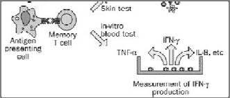 Testing Options Tuberculin Skin Test (TST) Interferon Gamma Release Assays (IGRAs) In vitro blood tests of cell