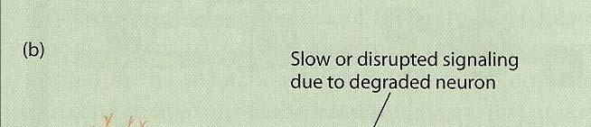 Slowing or