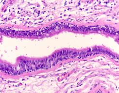 2. Normal Histology: Bronchiole Here is is important to