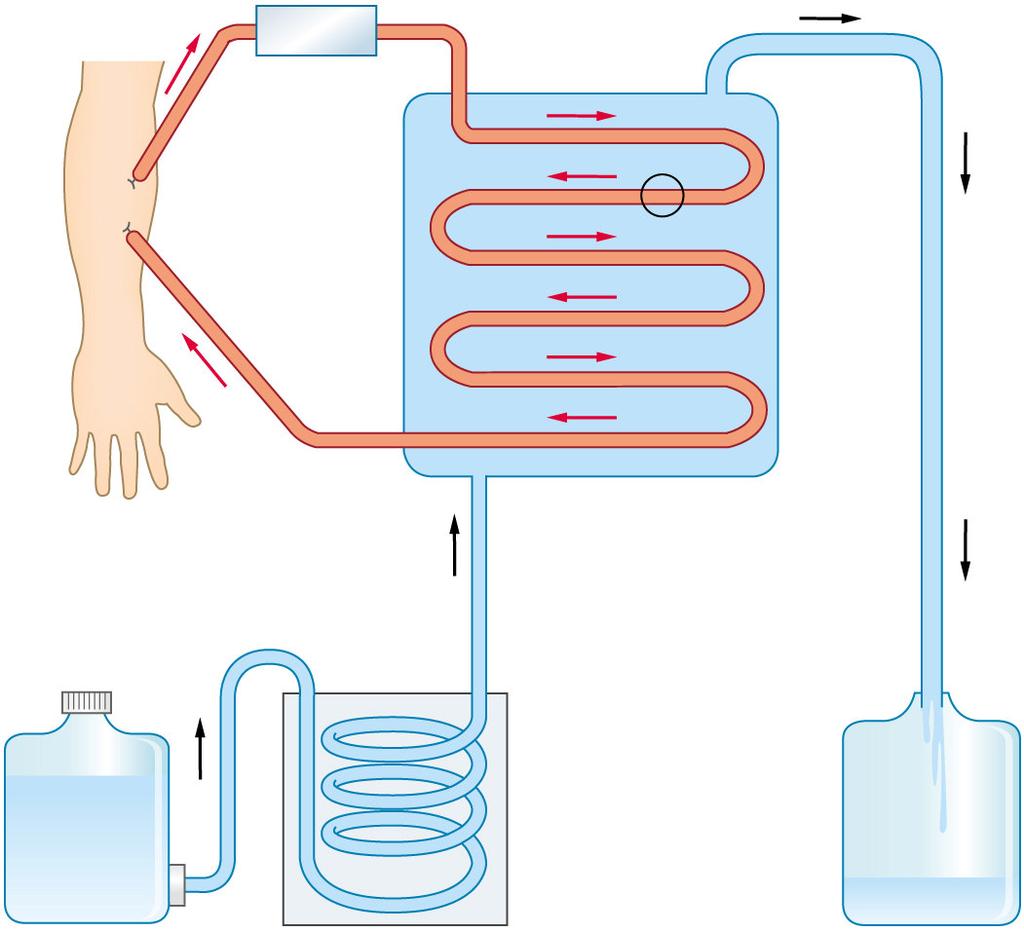 Features of the two parts of a dialysis machine and their significance: Dialysis tubing Dialysing ( 透析液 ) Feature It is (4) permeable. It only allows small molecules like urea to pass through.