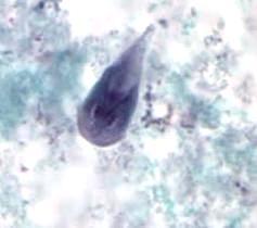 (5) Giardia intestinalis cyst stained