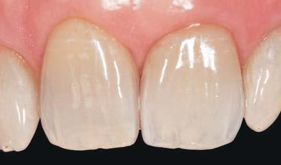 treatment involving dental implants or dentures.