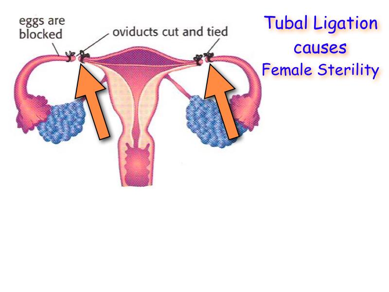 Uterus - the womb Site of menstruation; inner lining sheds or sloughs off;