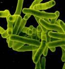 What Causes TB? Mycobacterium tuberculosis complex: several closely related mycobacteria that cause TB disease M.
