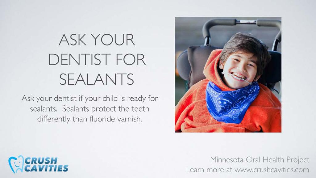 Sealants are not the same as fluoride varnish. Sealants are put on the chewing surfaces of permanent molars when the child is around the ages of 6-9.