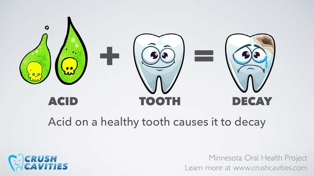 The acid lives in the plaque around your healthy tooth so without proper care, the acid will weaken the enamel of