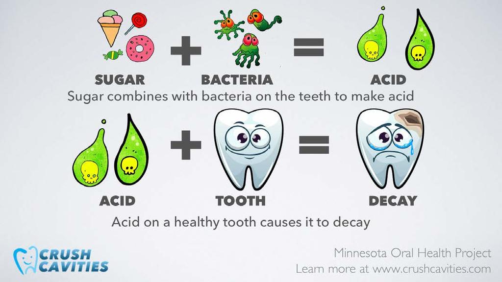 So, sugar plus bacteria equals acid and acid