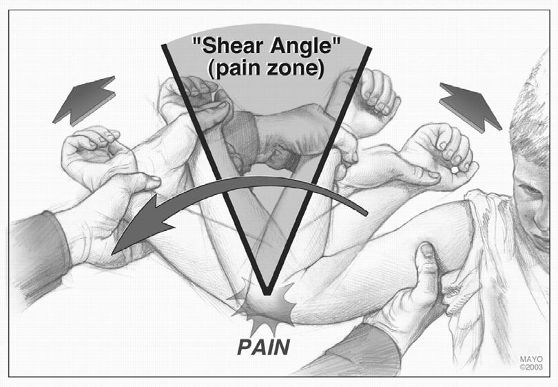 Moving Valgus Stress Test Pain must reproduce MCL pain Maximal pain 120-70 o Shear
