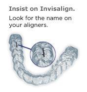 Learn How Straight Teeth Can Make You Look Younger, Earn More Income, Find That Loved One, Better Your Marriage & Overcome Shyness in One Hour or Less By Reading This Free Report Using Invisalign &