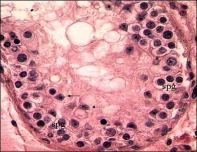 Spermatogenesis Sperm Development Sperms cells are derived from undifferentiated cells called SPERMATOGONIA (sing.