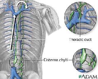 Lymph node: a closer look Thoracic Duct Cysterna Chyle 2-4 liters daily Lumbar