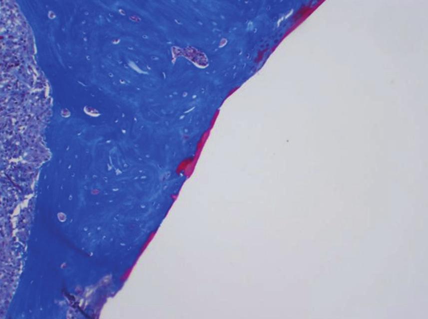 Figure 2: Photomicrograph of control Group 1 defect; prominent gap is present with no new bone