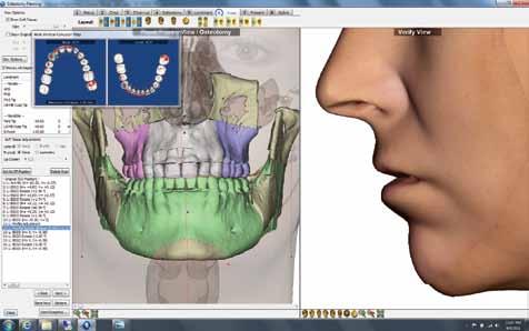 If you utilize 3D facial camera, Dolphin can process it; if not, Dolphin 3D Surgery can take full advantage of your clinical (2D) photographs.