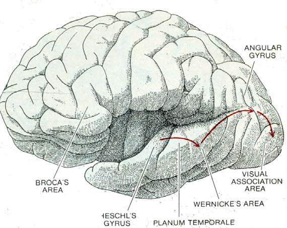 Scientific American, Freeman Press D. The planum temporale, which is the portion of the dorsal surface of the temporal lobe just posterior to the transverse gyrus (primary auditory cortex), 1.