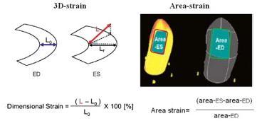 4D-strain and