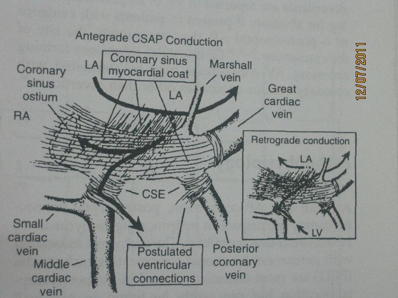 - Embryologically, the CS develops: + As a remnant of sinus venosus musculature and as a continuation of RA + 40 mm of the CS is surrounded: striated muscle, with connections to LA - When connected