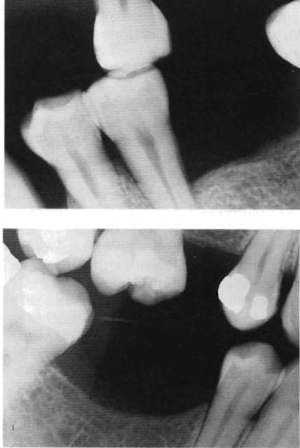 B- condition of teeth. 4.