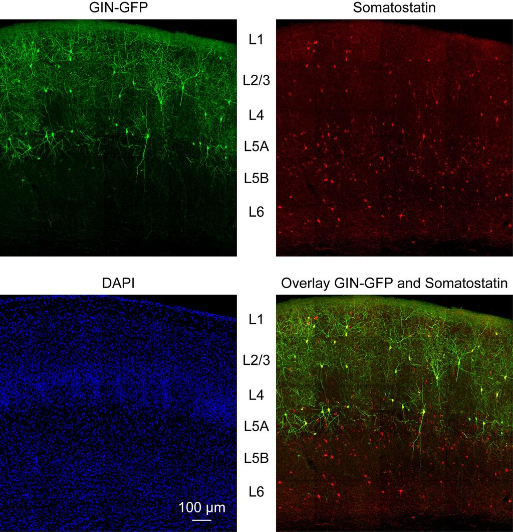 Supplementary Figure 2 Supplementary Figure 2. GIN-GFP neurons are a subset of somatostatin expressing neocortical neurons.