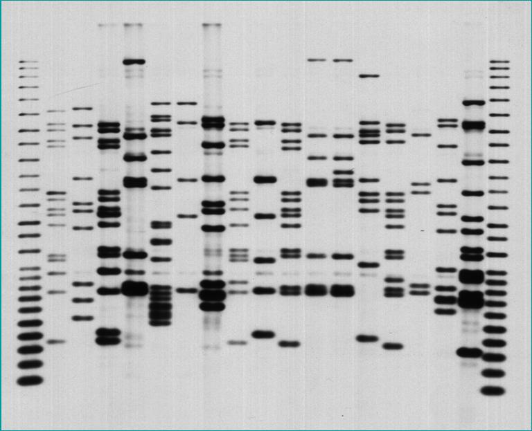 IS6110-RFLP fingerprinting Genotyping: Uses 1. Cross contamination studies 2.