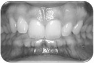 A stable dental malocclusion Find the musculoskeletally stable position.