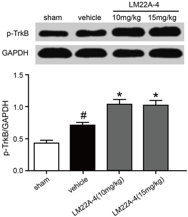 Figure 1. Influences of LM22A-4 treatment on p-trkb expression of injured spine cord tissue. In comparison with the solvent treatment, LM22A-4 significantly upregulated the expression of p-trkb.