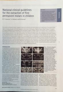 National clinical guidelines for the extraction of first permanent molars in children. M. T. Cobourne, A.