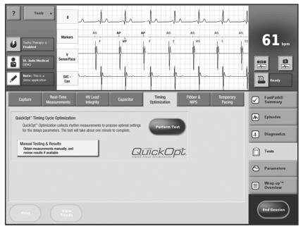 Programming QuickOpt QuickOpt Recommended Values QuickOpt Optimization QuickOpt optimization is clinically-proven to correlate with echo based methods: Prospective 11-patient pilot study 1 99.