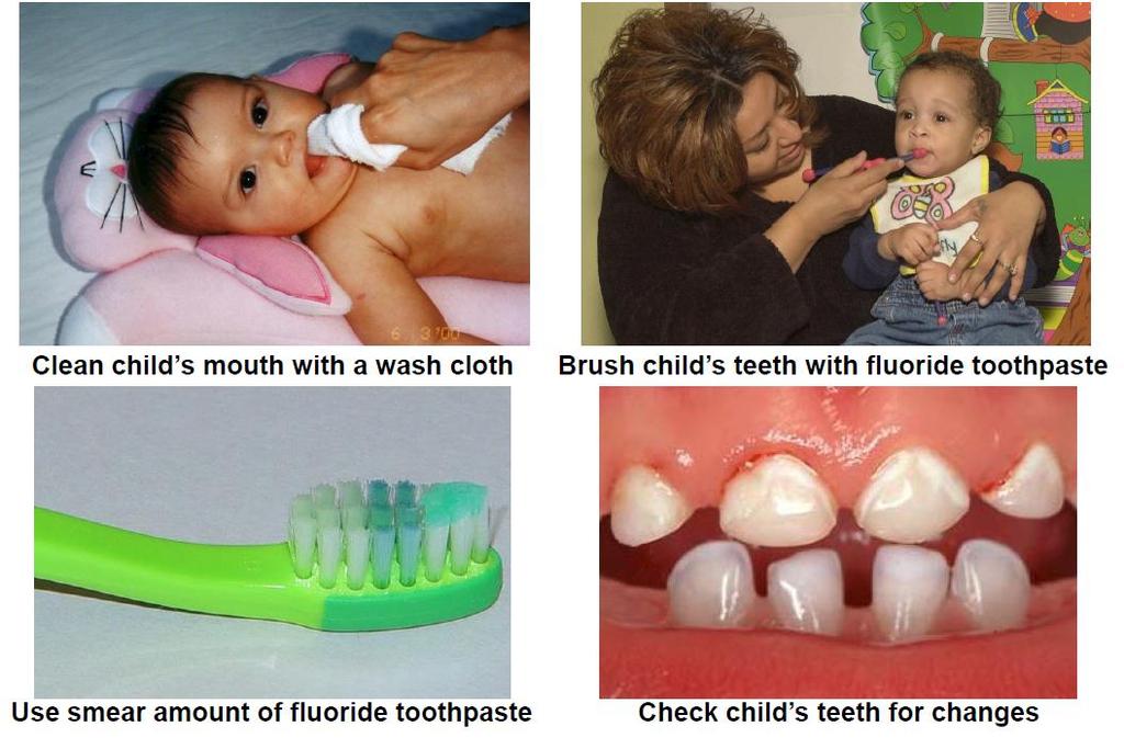 Basic Oral Health