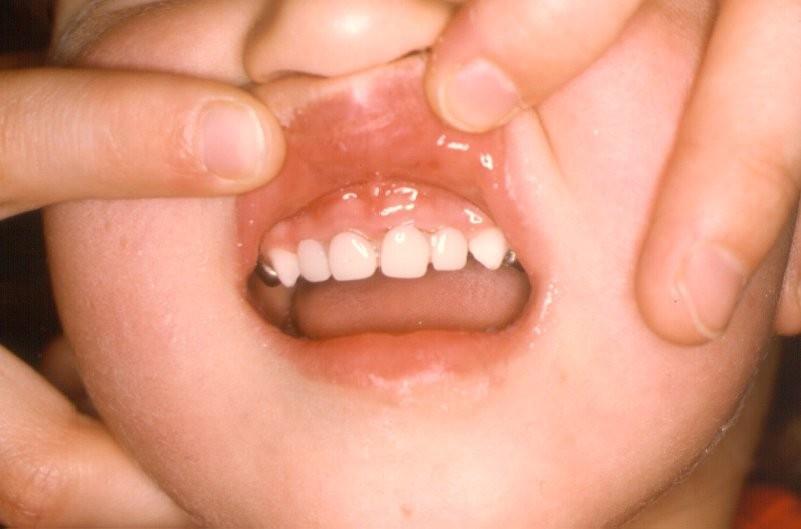 Teeth in