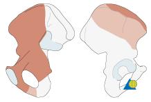 Iliopectineal fascia separates medial and middle window or tunica musculorum (iliopsoas and femoral n.) from tunica vasculorum (femoral a. and v.) Articular reductions are indirect.
