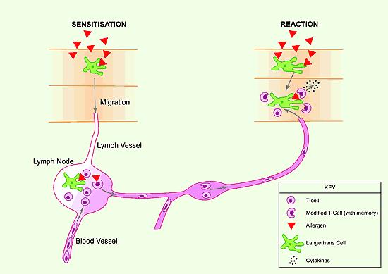 Sensitization Mechanism- Type IV