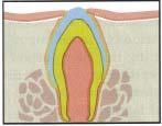 Apposition stage/ varies per tooth Induction, proliferation Dental tissues secreted as matrix in successive layers.