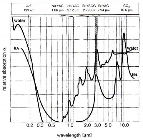 40 Spectroscopic Investigation of Tooth Caries and Demineralization Fig.2.11. Absorption of laser light in water and hydroxyapatite from 200 nm to 10 µm (Adapted from Koort HJ and Frentzen M.