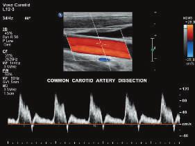Our most powerful architecture ever applied to vascular ultrasound EPIQ performance touches all aspects of acoustic acquisition and processing, allowing you to truly experience the evolution