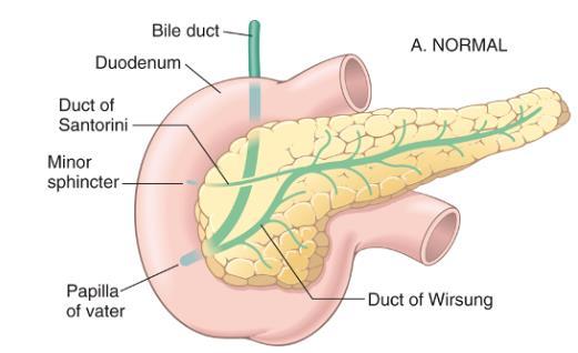 Pancreas divisum The most congenital anomaly that