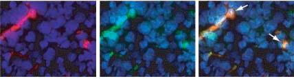 NGR-TNF induces apoptosis of tumor vessel endothelial cells in vivo RMA lymphoma