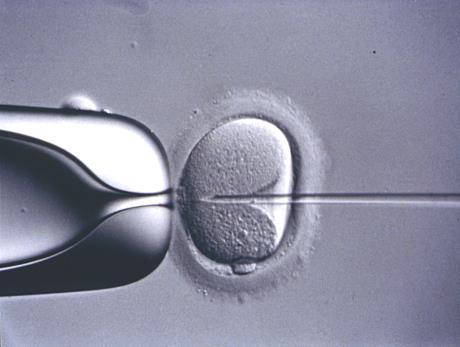 Intracytoplasmic sperm injection (ICSI): 1992 effective bypass (not treatment) for male infertility Providing viable sperm can be isolated in semen or testis, ART pregnancy rates in couples with