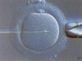 Insemination 30,000 motile sperm compete Intracytoplasmic sperm injection single morphologically normal
