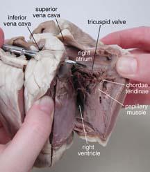 3. Insert your dissecting scissors or scalpel into the left auricle at the base of the aorta and make an incision down through the wall of the left atrium and ventricle, as shown by the dotted line