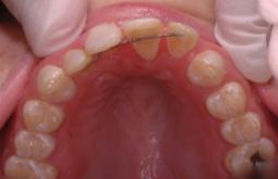 realistic treatment objectives for 21st century orthodontics 1.