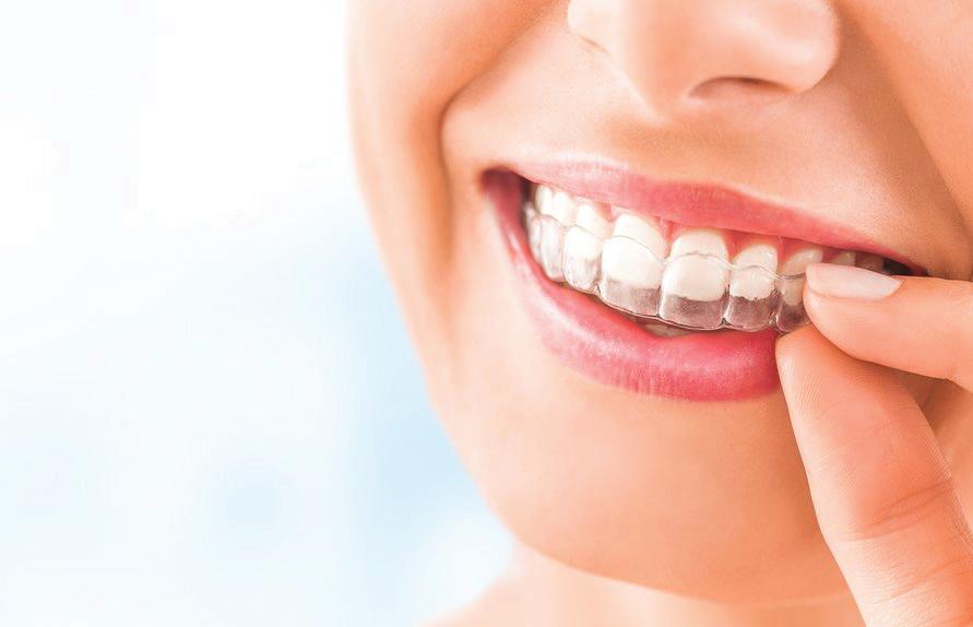 How Long Is the Retention Phase Once Braces Are Removed?