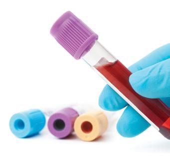 What are blood samples for? Blood Samples are commonly taken to check how different parts of the body are functioning.
