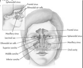 Disorders of the Upper Airway Allergic rhinitis and allergic conjunctivitis Medical management/nursing interventions Avoid allergen Antihistamines Decongestants Topical or nasal corticosteroids