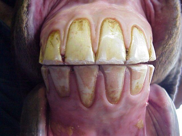 Abnormal Incisor Shapes