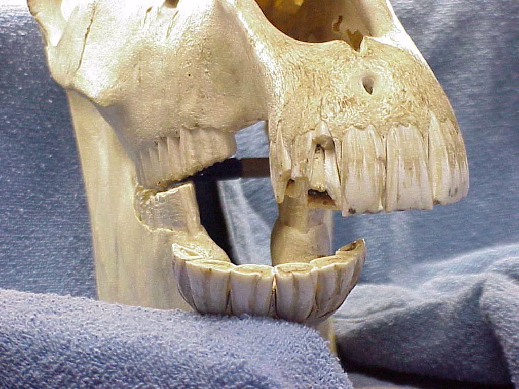 Resting position Incisors in contact