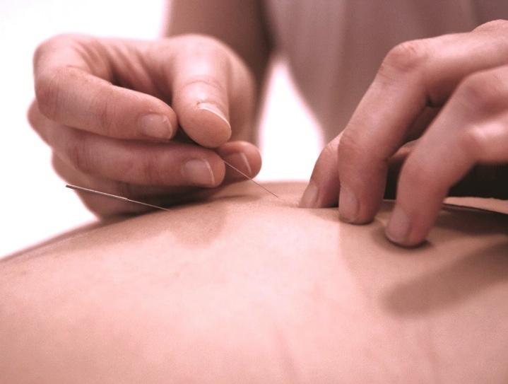 www.ilaira.com Acupuncture It is by virtue of the twelve meridians that human life exists, that disease arises, that people can be treated and illness cured.