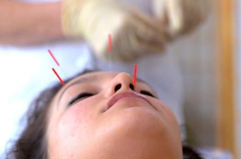 Acupuncture is one of the safest treatments available in both conventional and alternative medicine and there are virtually no side effects when practised by a properly trained practitioner.