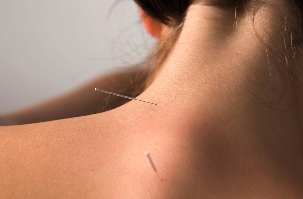 Acupuncture Ιs acupuncture painful? Although you may feel a small prick, usually acupuncture is not painful.