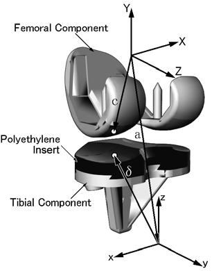 22 M. A. HOSSAIN, M. FUKUNAGA and S. HIROKAWA contact point trajectories between the articulating surfaces. Fig.2 A 3-dimensional mathematical model of a femoral component and a polyethylene insert.